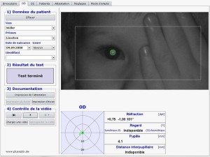 cache_Nystagmus-plus-optix-freedom-medical-tunisie-sousse