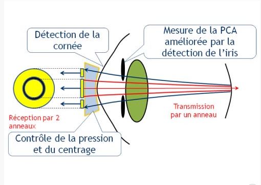 AL-4000 -illustration de la prise de mesure-ophtalmologies-tunisia-freedom-company