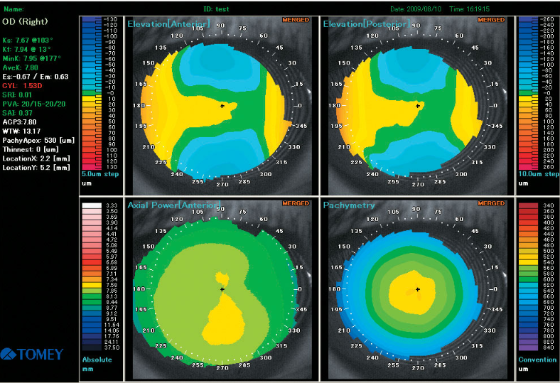 Affichage multiple-ophtalmologies-tunisia-freedom-médicale