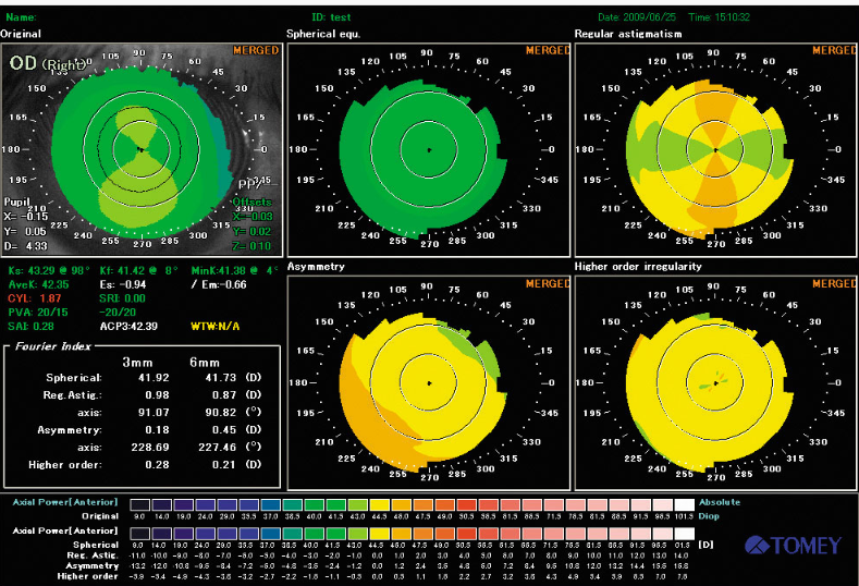 Analyse de Fourier-tomey-ophtalmologies-tunisia-freedom-company
