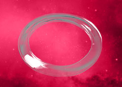 Anillo-de-simblefaron-ophtalmologies-oculoplasty-tunisia-freedom-medicale