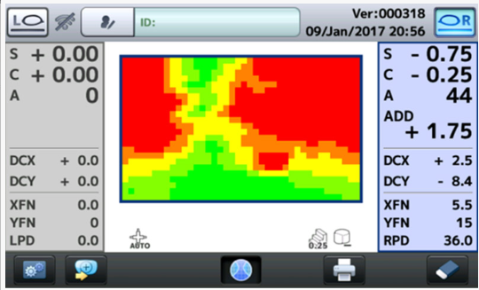 Cartographie de puissance-ophtalmologies-produits-tunisia-freedom