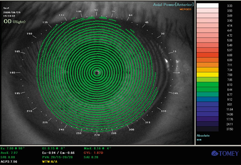 Image Placido-ophtalmologies-tunisia-freedom-company