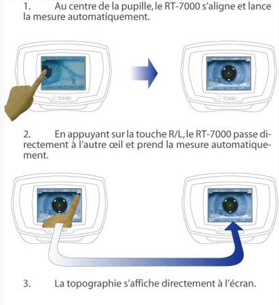 Mesure rapide et automatique-ophtalmologies-freedom-medicale