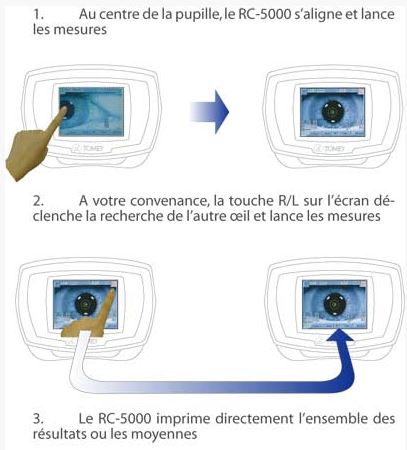 Mesure rapide et automatique-ophtalmologies-tunisia-freedom
