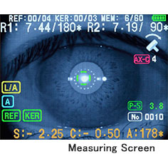 Retinomax Series-photo7-ophtalmologies-tunisia-freedom