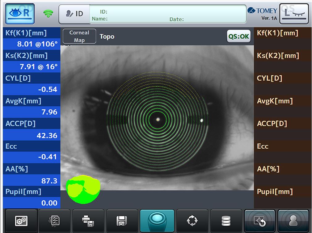 mr600-ophtalmologies-tomey-tunisia-freedom-medicale